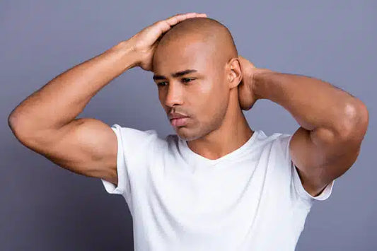 man with shaved head holding his scalp